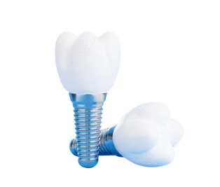 Implant Care You Can Trust